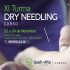 XI Curso de Dry Needling
